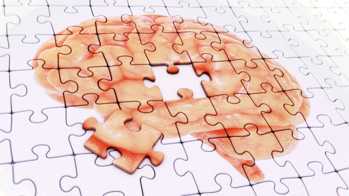 Symbolbild für Gedächtnisverlust: Ein Puzzle ergibt ein Gehirn mit einem fehlenden Teil © imago/Science Photo Library/Andrzej Wojcicki