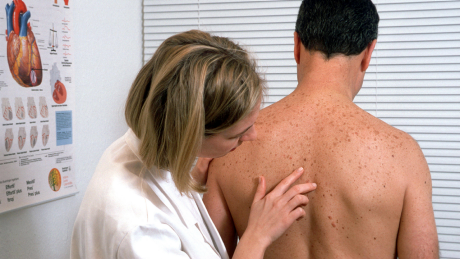 Dermatologin untersucht Haut © IMAGO / imagebroker