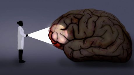 Wissenschaftlerin leuchtet mit einer Taschenlampe auf ein menschliches Gehirn © imago images/Ikon Images/Gary Waters
